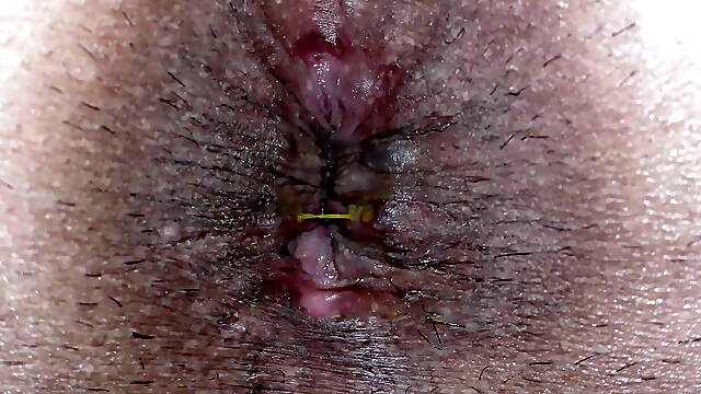 Mans Butt Hole Imagesvideos