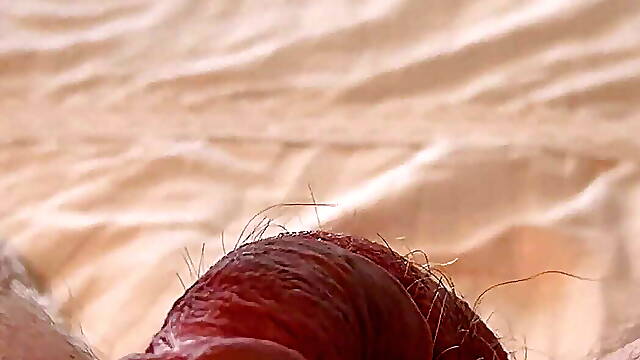 Prostate Electrojaculation Estim