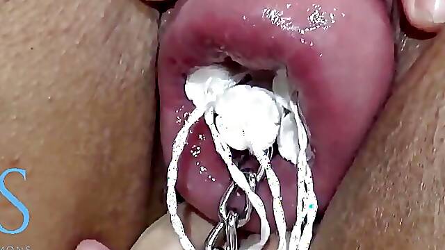Dance with Prolapsed Cervix Chain