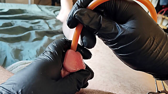 Catheter insertion 24FR