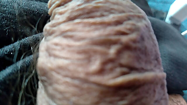Amazing wrinkled foreskin